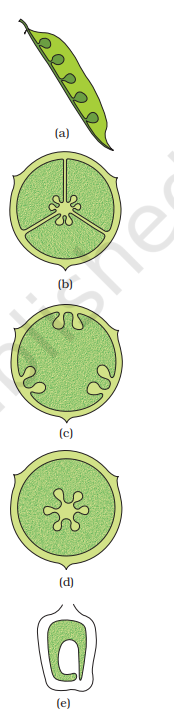 Types of placentation :(a) Marginal (b) Axile (c) Parietal (d) Free central (e) Basal